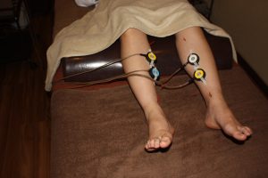 腰椎椎間板ヘルニアの足への鍼灸治療