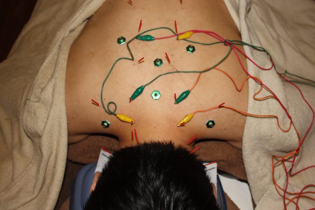 後頭神経痛について医師に相談する時期