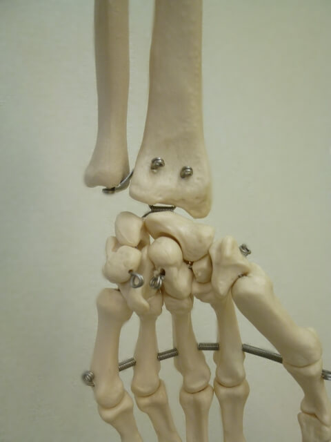 橈骨神経麻痺