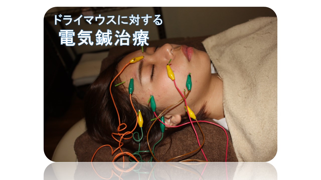 ドライマウスの電気鍼