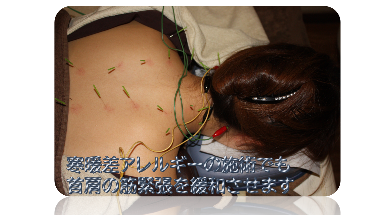 寒暖差アレルギーでも首肩の筋緊張は緩和させます